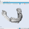 Maestro 3D Dental Studio V6 Crack